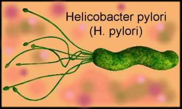 Heliobacter Pylori(2)